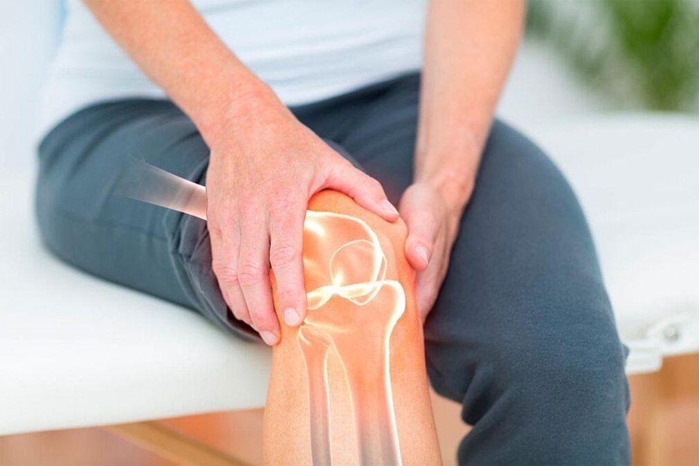 Knieschmerzen bei Arthritis und Osteoarthritis. 