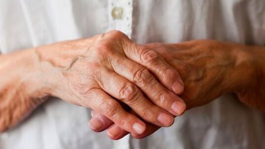 Rheumatoide Arthritis verursacht Schmerzen und Schwellungen in den Fingergelenken. 