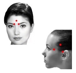 Punkte auf dem Kopf für Kopfschmerzen, die auf das Gesicht und Tempel